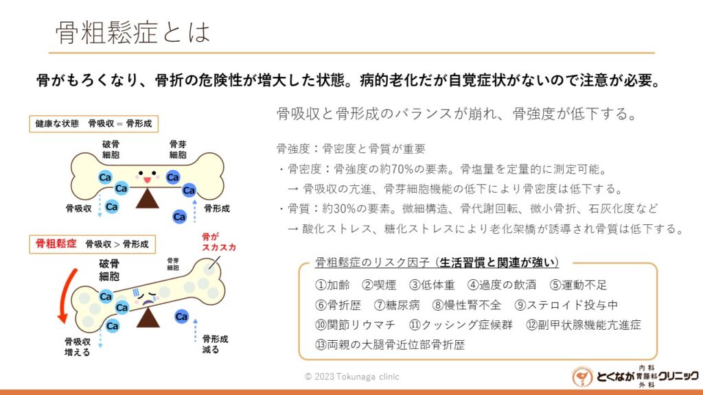 骨粗鬆症 のイメージ画像